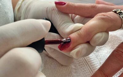 Segurança em primeiro lugar: A Anvisa proibiu, mas já estávamos à frente