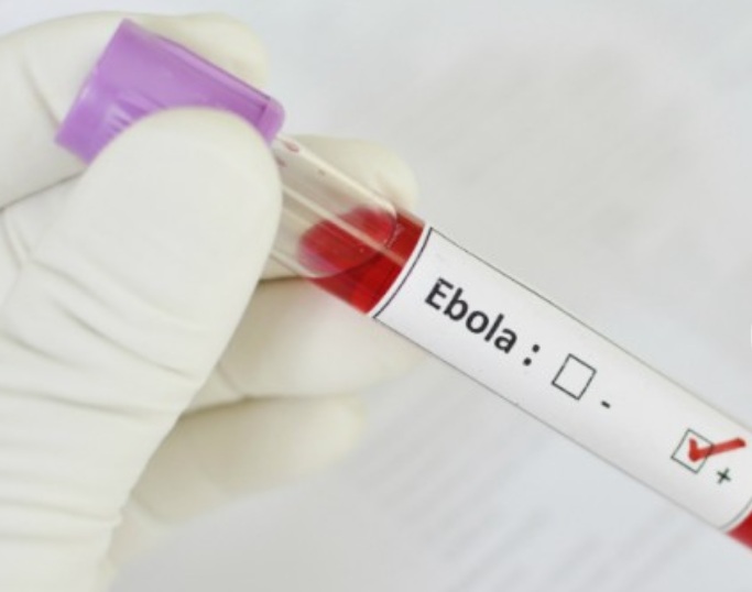 Vírus ebola proteja-se